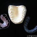 스마일디치과의원 네이버블로그