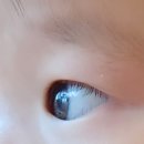 연세하늘안과의원 이미지