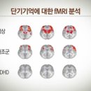 ebs 뉴스: ADHD 학습부진 "뇌가 원인" 이미지