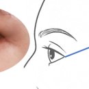 리터닝성형외과의원 이미지