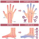 [성북구다이어트]셀포랩 슬림패스 순환관리 누워서 하는 다이어트(예신관리, 산후관리, 붓기관리 추천)