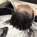 더블라인스칼프 네이버블로그