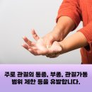 류마티스내과 명의의 진료가 필요할 때, 어떻게 해야 할까요? [대구 류마티스내과]
