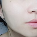 메디힐 비건 PDRN 수분세럼 마스크팩 쫀쫀함만 남은 후기