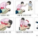 심장마비 전조 원인은 무엇 이미지