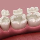 진치과기공소 이미지