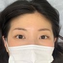 화명동 화정근린공원 내 | 일산 잔흔제거 더블랙라인 일산눈썹&amp;속눈썹 붉은눈썹 제거후기