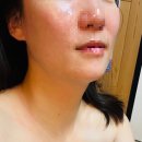 에스에이치 뷰티 방문후기 – 모공 관리 받고 피부가 달라졌어!