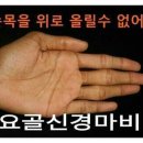 요골 신경마비 이미지