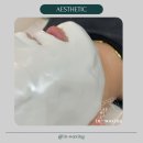 in_waxing 이미지