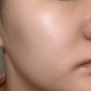 올메디 | 피부긴급처방 119앰플 올스킨 메디포뮬러 앰플 사용후기