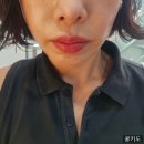 커피빈압구정현대아파트점 | 압구정피부과 : 어색함, 필러 움직임 X "팔자필러 필프팅" 내돈내산 후기