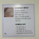 내돈내산 꿀광피부 보장 더마플래닝 보나뷰티 3회차 재방문후기