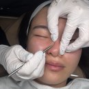 로드메디칼 | 뷰티)인티메잇 : 경기/남양주인티메잇, 다산왁싱,스킨,엑시드닝 스킨스켈링 2세대,남양주 피부관리...