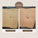 진바디케어 | 하남 미사 피부관리 리타임뷰티 하남미사점 바디케어 후기