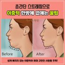 🤭 턱살~이중턱~한방에 없애는~"꿀팁" 이미지