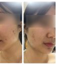 오룸스킨 이미지