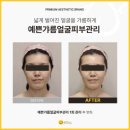 위뷰티