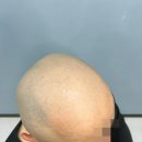 주식회사 경기태평양충전소 | 송내역두피문신 부작용 없이 자연스러운 곳을 찾는다면?