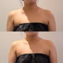 메트로팰리스2차A | 윤곽바디하다-부천신중동점' (=수앤수뷰티끄) 승모근과 드레스라인 매끈매끈하게 정리하고 온 솔직후기-