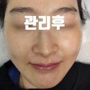 명품태권도장 | 대구 북구 정보떼뷰티샵 피부관리 후기