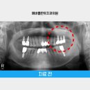 에버플란트치과의원 이미지