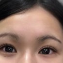 메디레스큐 | 대구 죽전역 속눈썹 연장 맛집 추천 [코레스큐 본점 (전 뷰티플러스)]