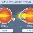 e편한 안경 이미지