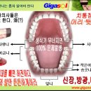 잇몸 질환 치료방법~~결국 소장의 문제~~ 이미지