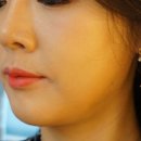 포마티 | 압구정역피부과 인모드 포마 FX 효과 후기 (당일~일주일차까지 솔직 기록)