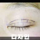 비씨아이 이미지