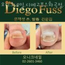 오니크네일 이미지