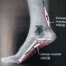 방촌든든한정형외과의원 | 저림 발바닥 앞쪽 통증 지압판 이거 가지고는 절대 회복 못했어요 [방촌든든한정형외과 방촌동 정형외과]