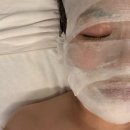 시흥웨딩케어 빛나고싶은날 | 엑스터 레이저 케어 본식 전 관리 추천
