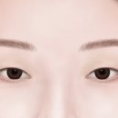 압구정서울성형외과 네이버블로그