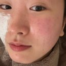 부평대로 | 쥬베룩 3차 완주 후기! 1차 효과, 손주사 통증, 솔직 비교 (내돈내산 GIF)⁠