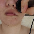 광교 피부관리 미유 에스테틱 광교점 프리미엄 케어 만족후기