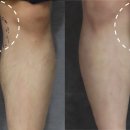 더(The)예쁜얼굴만들기성형외과의원 이미지