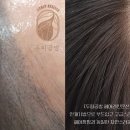 두피공방헤어라인