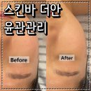 더안 | 천호동 피부관리 스킨바 더안 작은얼굴 윤곽관리 후기