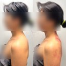 라온제나 피부바디샵 | 개봉피부샵 추천 라온제나피부바디샵 개봉점 등관리 솔직후기