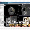 원주STM치과의원 네이버블로그