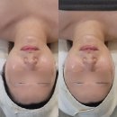 [평택] 꼼꼼하고 섬세한 윤곽관리로 부종이 싹 ~ 사라지게하는 마법 :: 바디채움빚다