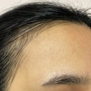 분당솔브 | 딥솔브 고주파마사지기 더마 엘릭서 출산 선물로 받은 후기