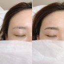 서연 | 마곡 발산역 자연눈썹 서연브로우 눈썹문신 시술 후기