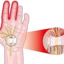 손목 통증 손목 통증 원인과 관리 방법 이미지