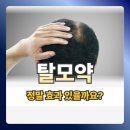 청주내과 탈모약, 정말 효과 있을까요? – Q&amp;A로 정리한 탈모약의 진실