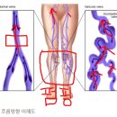 박승연피부관리 | 운동 체험 고혈압,당료,피부통증,무릎통증,전립선염,유방암예방 림프선운동기구,허리통증 운동기구...