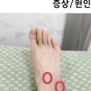 이원섭한의원 네이버블로그