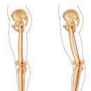 몸애, 끌림 이미지